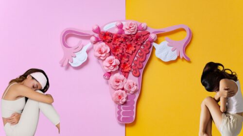 Endometriosis Myths and Mistakes: The Importance of Awareness and Coordinated Care