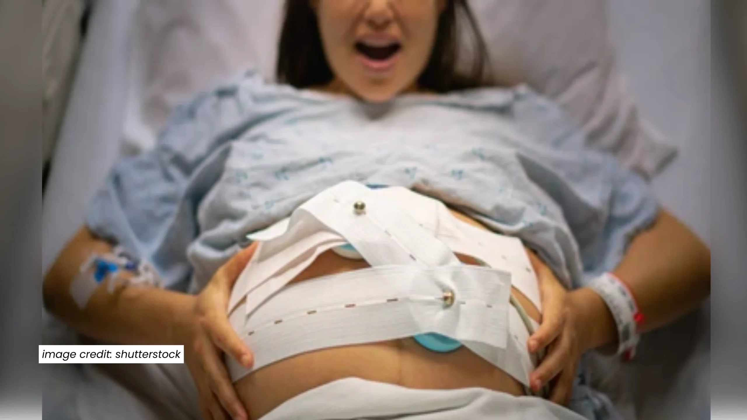 C-Section Account for One in Three Cases of Postpartum Haemorrhage, Lancet Series Finds